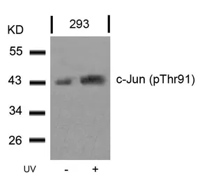 Anti-c-Jun (phospho Thr91) antibody used in Western Blot (WB). GTX50100