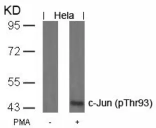 Anti-c-Jun (phospho Thr93) antibody used in Western Blot (WB). GTX50101