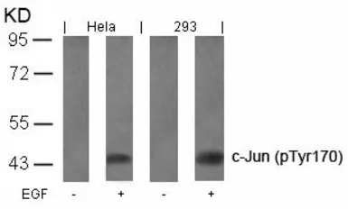 Anti-c-Jun (phospho Tyr170) antibody used in Western Blot (WB). GTX50102