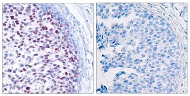 Anti-c-Jun (phospho Thr239) antibody used in IHC (Paraffin sections) (IHC-P). GTX50103