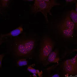 Anti-JunB (phospho Ser79) antibody used in Immunocytochemistry/ Immunofluorescence (ICC/IF). GTX50105