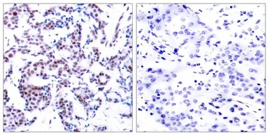 Anti-JunB (phospho Ser259) antibody used in IHC (Paraffin sections) (IHC-P). GTX50106