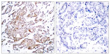 Anti-c-Myc (phospho Thr58) antibody used in IHC (Paraffin sections) (IHC-P). GTX50111