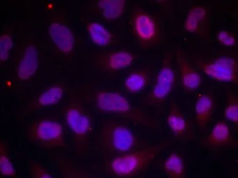 Anti-MEF2A (phospho Thr312) antibody used in Immunocytochemistry/ Immunofluorescence (ICC/IF). GTX50114