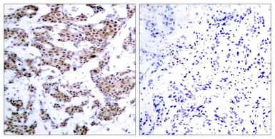 Anti-MEF2A (phospho Thr312) antibody used in IHC (Paraffin sections) (IHC-P). GTX50114