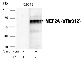 Anti-MEF2A (phospho Thr312) antibody used in Western Blot (WB). GTX50114