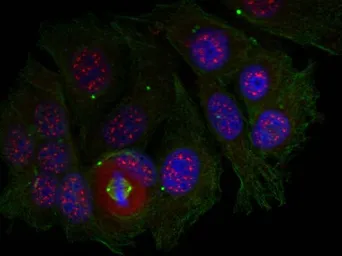 Anti-MEF2A (phospho Thr319) antibody used in Immunocytochemistry/ Immunofluorescence (ICC/IF). GTX50115