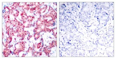 Anti-GATA1 (phospho Ser142) antibody used in IHC (Paraffin sections) (IHC-P). GTX50116