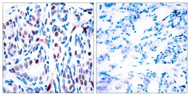 Anti-STAT3 (phospho Tyr705) antibody used in IHC (Paraffin sections) (IHC-P). GTX50119
