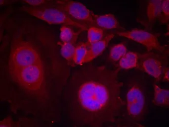 Anti-STAT3 (phospho Ser727) antibody used in Immunocytochemistry/ Immunofluorescence (ICC/IF). GTX50120