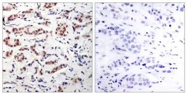 Anti-STAT5A (phospho Tyr694) antibody used in IHC (Paraffin sections) (IHC-P). GTX50122