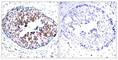 Anti-STAT5A (phospho Ser780) antibody used in IHC (Paraffin sections) (IHC-P). GTX50123