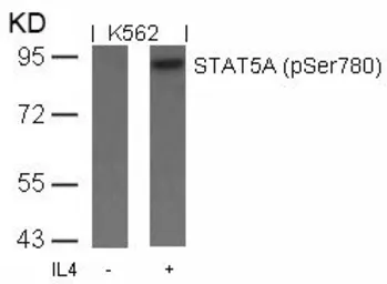 Anti-STAT5A (phospho Ser780) antibody used in Western Blot (WB). GTX50123