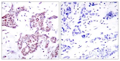 Anti-STAT6 (phospho Tyr641) antibody used in IHC (Paraffin sections) (IHC-P). GTX50124