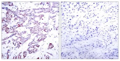 Anti-STAT6 (phospho Thr645) antibody used in IHC (Paraffin sections) (IHC-P). GTX50125