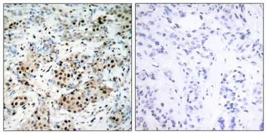 Anti-CREB (phospho Ser133) antibody used in IHC (Paraffin sections) (IHC-P). GTX50126