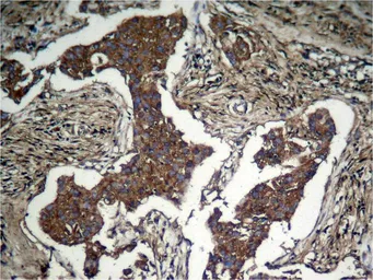 Anti-AKT (phospho Ser473) antibody used in IHC (Paraffin sections) (IHC-P). GTX50128