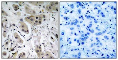 Anti-AKT (phospho Ser473) antibody used in IHC (Paraffin sections) (IHC-P). GTX50128