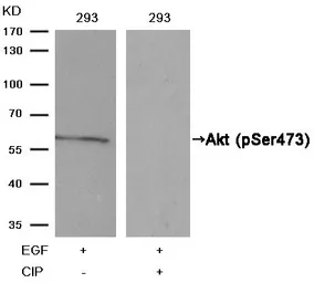 Anti-AKT (phospho Ser473) antibody used in Western Blot (WB). GTX50128