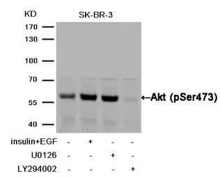 Anti-AKT (phospho Ser473) antibody used in Western Blot (WB). GTX50128