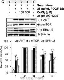 Anti-AKT (phospho Ser473) antibody used in Western Blot (WB). GTX50128