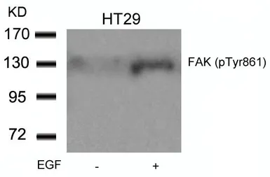 Anti-FAK (phospho Tyr861) antibody used in Western Blot (WB). GTX50133