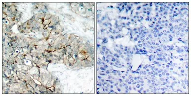 Anti-Integrin beta 3 (phospho Tyr773) antibody used in IHC (Paraffin sections) (IHC-P). GTX50134