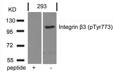 Anti-Integrin beta 3 (phospho Tyr773) antibody used in Western Blot (WB). GTX50134