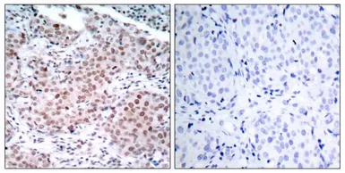 Anti-Estrogen Receptor alpha (phospho Ser104) antibody used in IHC (Paraffin sections) (IHC-P). GTX50137