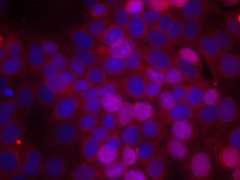 Anti-Estrogen Receptor alpha (phospho Ser106) antibody used in Immunocytochemistry/ Immunofluorescence (ICC/IF). GTX50138