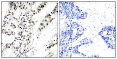 Anti-Estrogen Receptor alpha (phospho Ser106) antibody used in IHC (Paraffin sections) (IHC-P). GTX50138