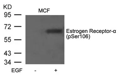 Anti-Estrogen Receptor alpha (phospho Ser106) antibody used in Western Blot (WB). GTX50138