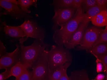 Anti-Estrogen Receptor alpha (phospho Ser167) antibody used in Immunocytochemistry/ Immunofluorescence (ICC/IF). GTX50140