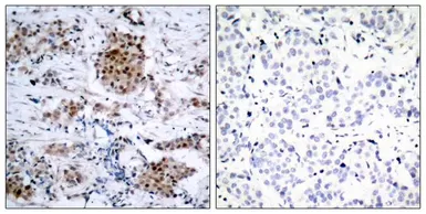 Anti-Estrogen Receptor alpha (phospho Ser167) antibody used in IHC (Paraffin sections) (IHC-P). GTX50140