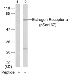 Anti-Estrogen Receptor alpha (phospho Ser167) antibody used in Western Blot (WB). GTX50140