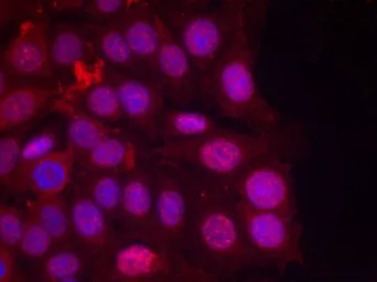 Anti-Progesterone Receptor (phospho Ser190) antibody used in Immunocytochemistry/ Immunofluorescence (ICC/IF). GTX50141