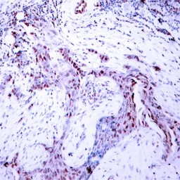 Anti-Progesterone Receptor (phospho Ser190) antibody used in IHC (Paraffin sections) (IHC-P). GTX50141