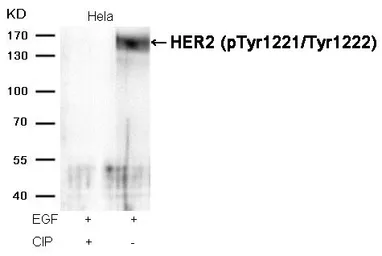 Anti-Her2 / ErbB2 (phospho Tyr1221/Tyr1222) antibody used in Western Blot (WB). GTX50143
