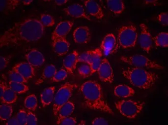 Anti-Her2 / ErbB2 (phospho Tyr1248) antibody used in Immunocytochemistry/ Immunofluorescence (ICC/IF). GTX50146