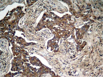 Anti-Her2 / ErbB2 (phospho Tyr1248) antibody used in IHC (Paraffin sections) (IHC-P). GTX50146