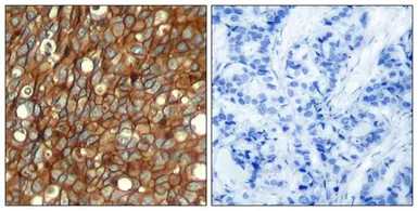Anti-Her2 / ErbB2 (phospho Tyr1248) antibody used in IHC (Paraffin sections) (IHC-P). GTX50146