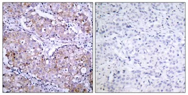 Anti-EGFR (phospho Ser1046) antibody used in IHC (Paraffin sections) (IHC-P). GTX50147