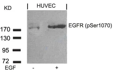 Anti-EGFR (phospho Ser1046) antibody used in Western Blot (WB). GTX50147