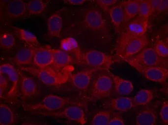 Anti-VEGF Receptor 2 (phospho Tyr1175) antibody used in Immunocytochemistry/ Immunofluorescence (ICC/IF). GTX50151