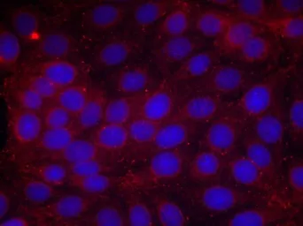 Anti-VEGF Receptor 2 (phospho Tyr1214) antibody used in Immunocytochemistry/ Immunofluorescence (ICC/IF). GTX50152