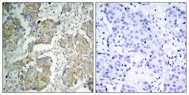 Anti-VEGF Receptor 2 (phospho Tyr1214) antibody used in IHC (Paraffin sections) (IHC-P). GTX50152
