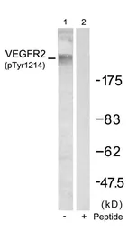 Anti-VEGF Receptor 2 (phospho Tyr1214) antibody used in Western Blot (WB). GTX50152