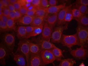 Anti-VEGF Receptor 2 (phospho Tyr951) antibody used in Immunocytochemistry/ Immunofluorescence (ICC/IF). GTX50153