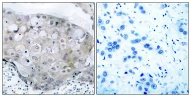 Anti-VEGF Receptor 2 (phospho Tyr951) antibody used in IHC (Paraffin sections) (IHC-P). GTX50153
