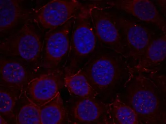 Anti-IGF1R beta (phospho Tyr1135 / Tyr1136) / Insulin Receptor beta (phospho Tyr1150 / Tyr1151) antibody used in Immunocytochemistry/ Immunofluorescence (ICC/IF). GTX50154